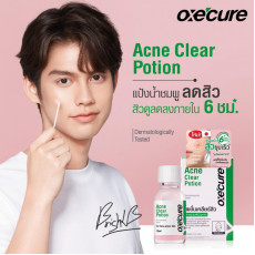 Oxe cure acne clear potion暗瘡消炎水